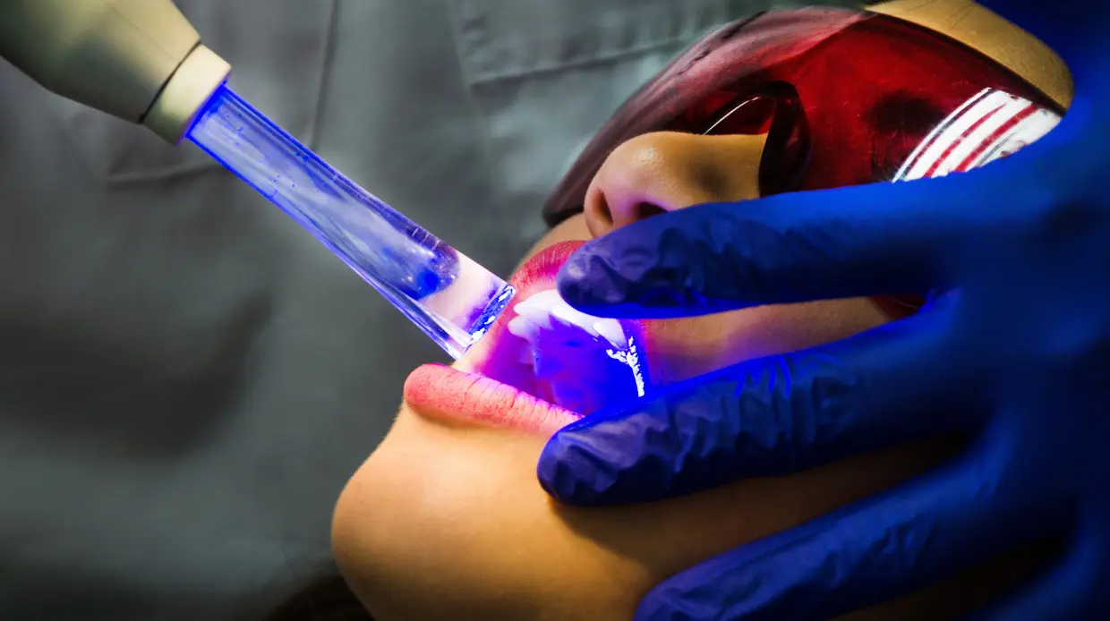 Laser odontológico: conheça as aplicações e vantagens